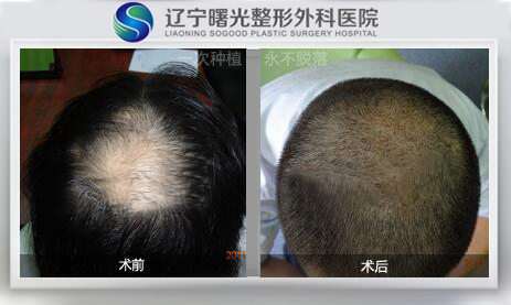 fee79088c27533650be10854e33b593d.jpg