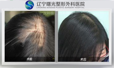 1bcf6bee7b23440628851ee2836163d2.jpg