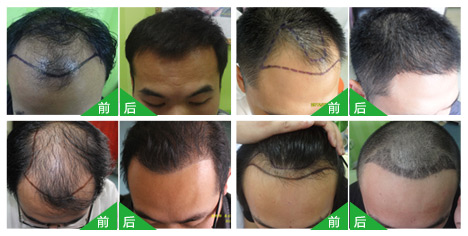 d6d9fc1b2b6b9a1db68caf8f286a1228.jpg