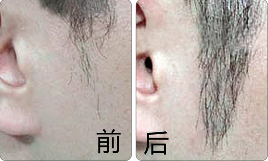 ޽ֲô