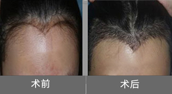 mtr.jpg